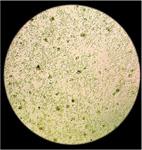 Healthy untreated white blood cells from mouse