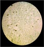 Mouse white blood cells after treatment, virtually no change.