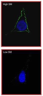 Top: The VacA toxin (fluorescent green) readily binds to human cell membranes that are rich in sphingomyelin.Bottom: VacA binding is significantly reduced when cell membranes are depleted of sphingomyelin. The cell nucleus is blue. (Micrograph courtesy of Vijay Gupta.)