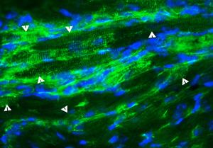 Treatment with stem cells derived from blood vessels prompted nestin-positive stem cells already present in the heart to form new cardiac muscle cells (see arrows). (Photo by Suzanne Berry-Miller)