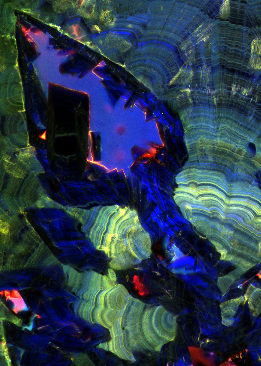 Fluorescence micrograph of a human kidney stone from the Mayo Clinic. (Image provided by Mayandi Sivaguru, Jessica Saw from Bruce Fouke Lab, Carl R. Woese Institute for Genomic Biology, U of I.)