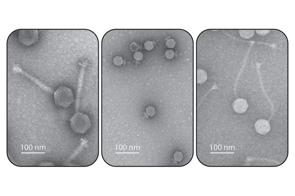 Electron micrographs of bacterial viruses, also known as phages.