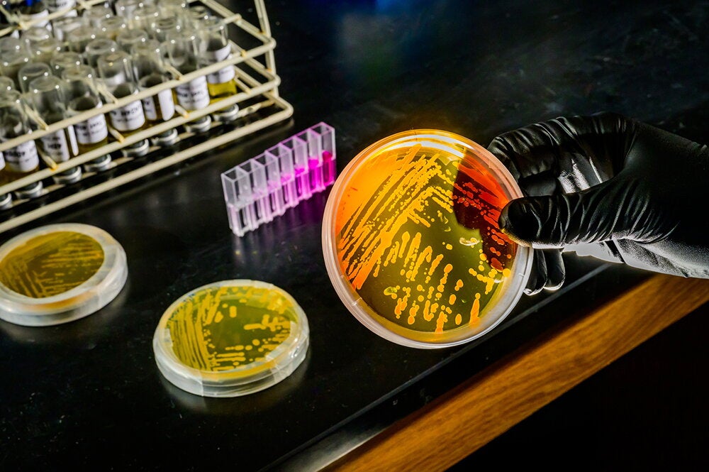 Weaponizing bacterial viruses to combat superbugs | College of