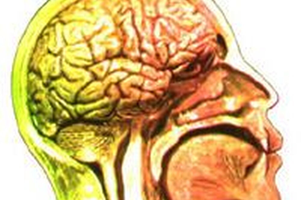 Healthy Brains