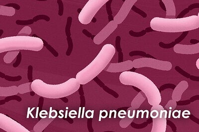 Klebsiella pneumoniae