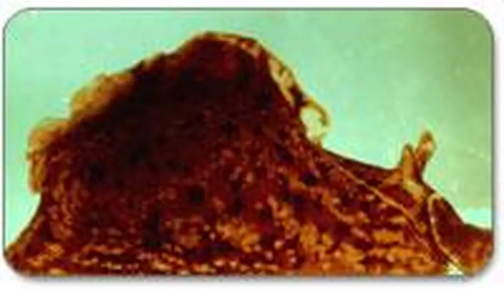 Mollusks Unlikely Ally in Serotonin Research
