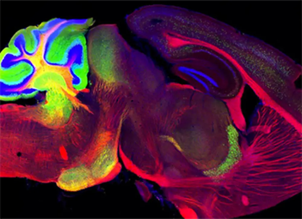 LAS students honored in Image of Research competition
